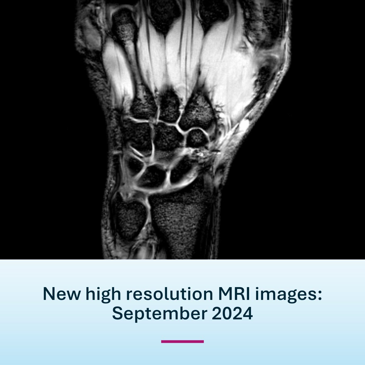 New MRI wrist images Magnetica September 2024 feature image